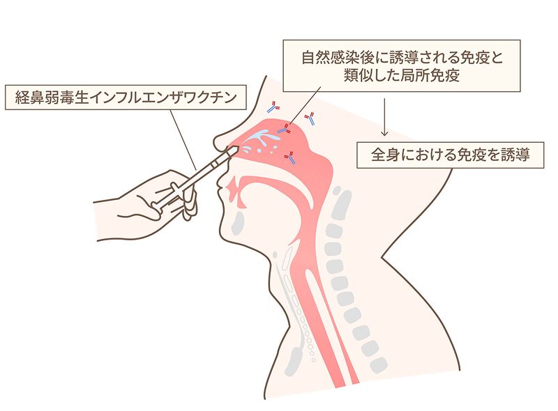 経鼻弱毒生インフルエンザワクチンを鼻腔内に噴霧し、自然感染に類似した局所免疫と全身免疫を誘導する仕組みを示した図
